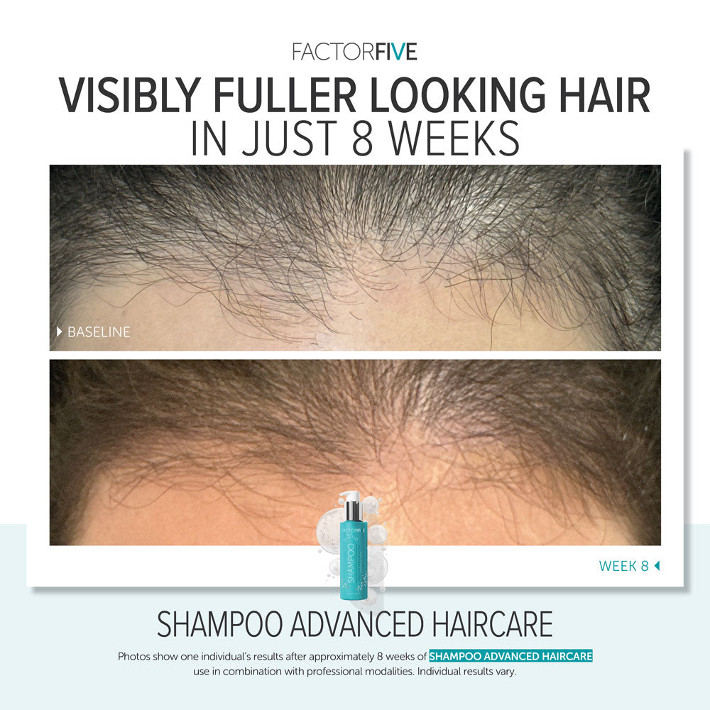 FACTORFIVE Advanced Haircare Shampoo
