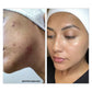 Vivant 8% Mandelic Acid Serum