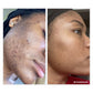 Vivant 8% Mandelic Acid Serum