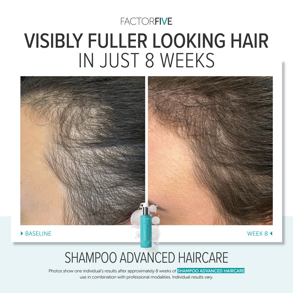 FACTORFIVE Advanced Haircare Shampoo