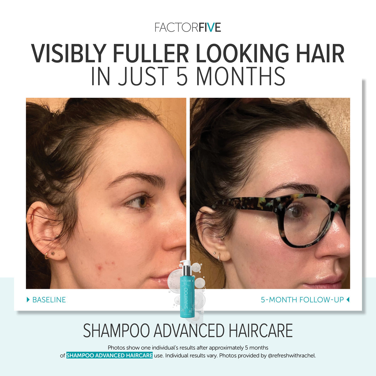 FACTORFIVE Advanced Haircare Shampoo
