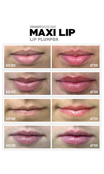 MAXILIP Lip Plumper