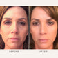 Osmosis Recovery | Omega & Probiotic Wellness for Skin Volume
