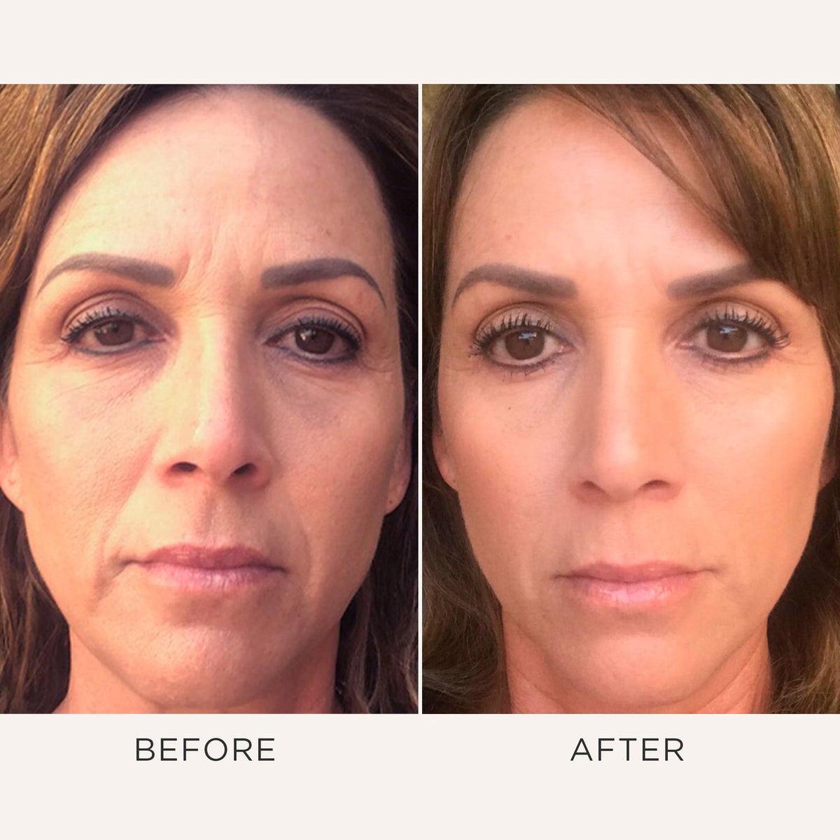 Osmosis Recovery | Omega & Probiotic Wellness for Skin Volume