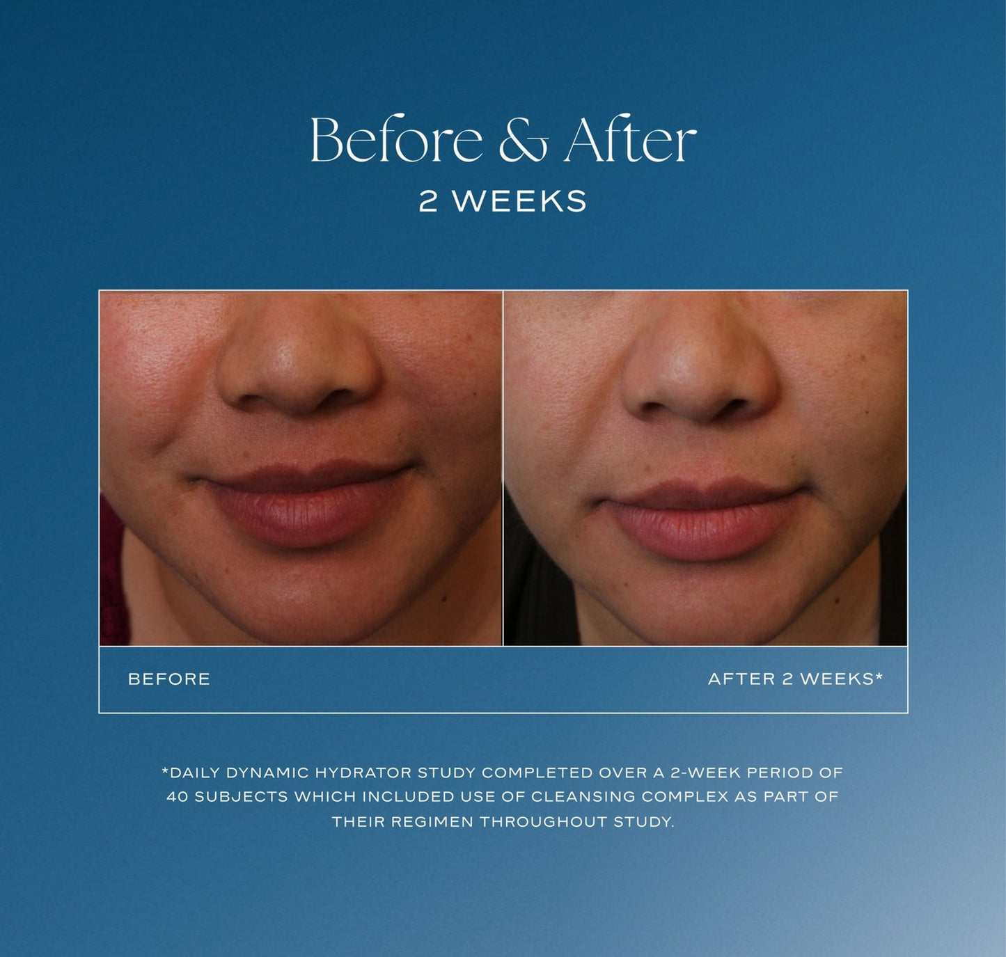 Daily Dynamic Hydrator